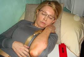 Ucraina: Yulia Timoshenko ricoverata in ospedale, stop allo sciopero della fame